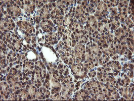 TBCC Antibody in Immunohistochemistry (Paraffin) (IHC (P))