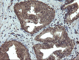 TBCC Antibody in Immunohistochemistry (Paraffin) (IHC (P))