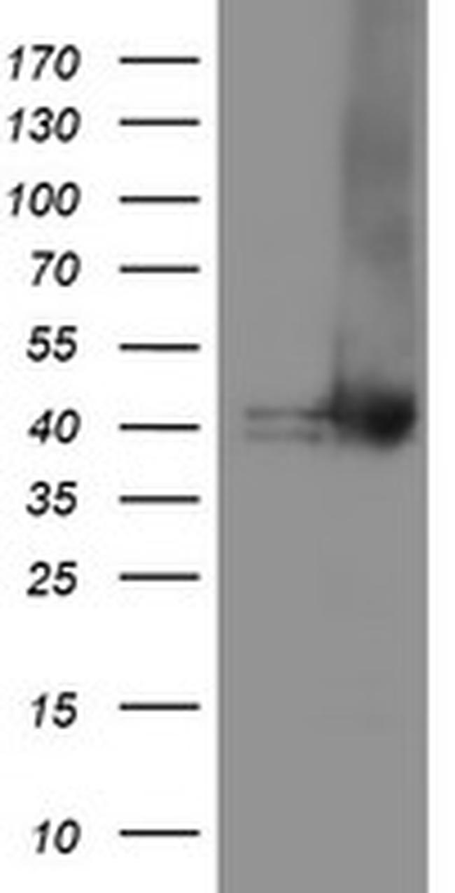 TBCC Antibody in Western Blot (WB)