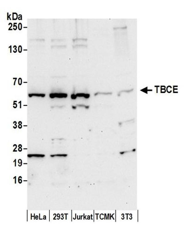 TBCE Antibody in Western Blot (WB)