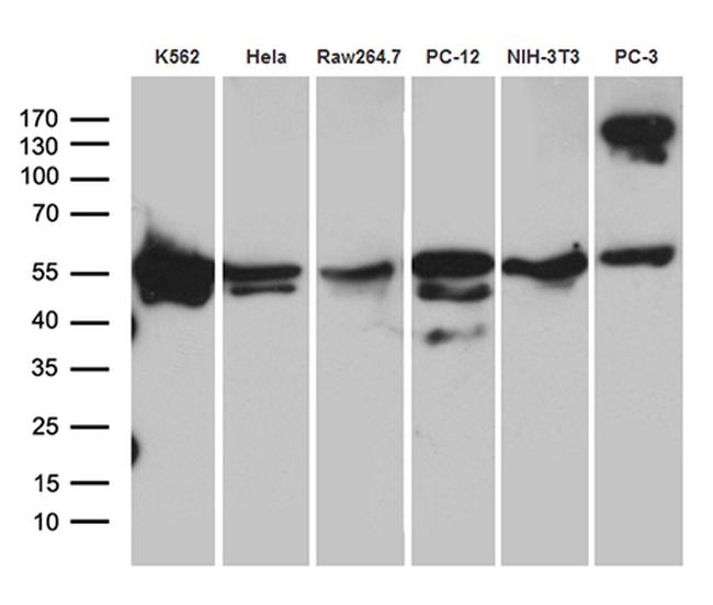 TBL1XR1 Antibody in Western Blot (WB)