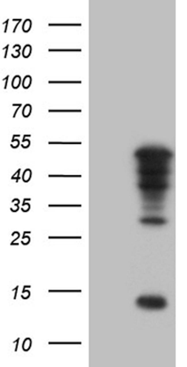 TBX20 Antibody in Western Blot (WB)