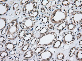 TBXAS Antibody in Immunohistochemistry (Paraffin) (IHC (P))