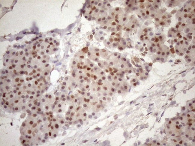 TCEAL1 Antibody in Immunohistochemistry (Paraffin) (IHC (P))