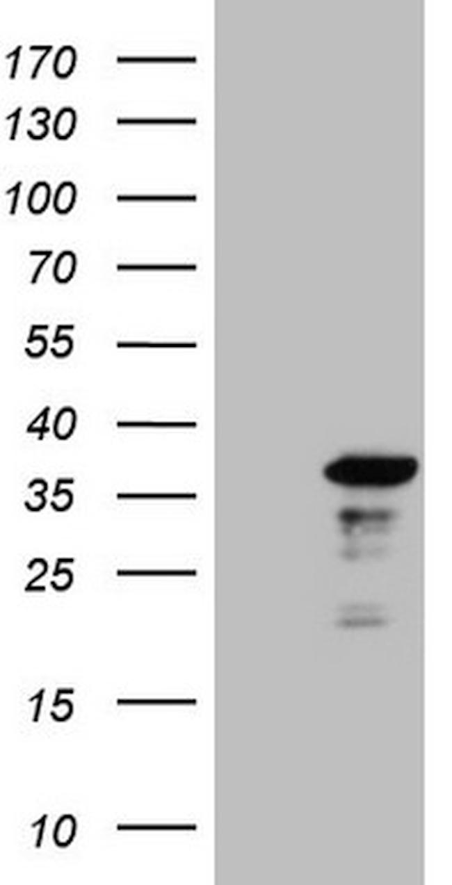 TCEAL1 Antibody in Western Blot (WB)