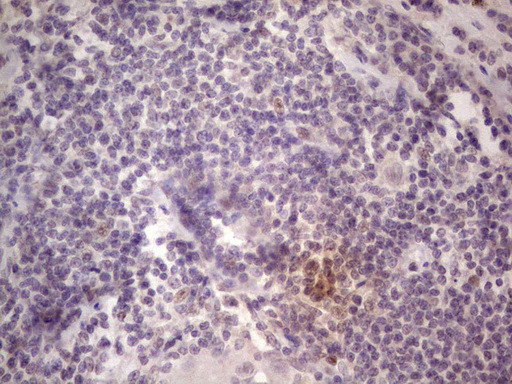 TCF12 Antibody in Immunohistochemistry (Paraffin) (IHC (P))