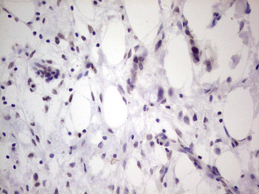 TCF12 Antibody in Immunohistochemistry (Paraffin) (IHC (P))