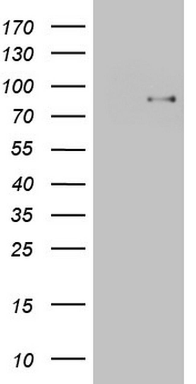 TCF12 Antibody in Western Blot (WB)