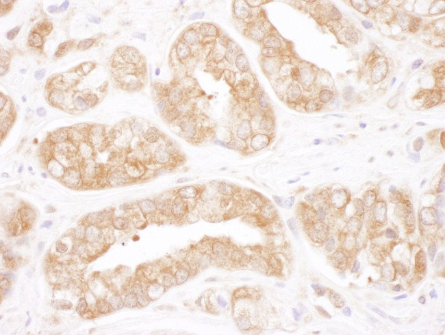 TCP1 Antibody in Immunohistochemistry (IHC)