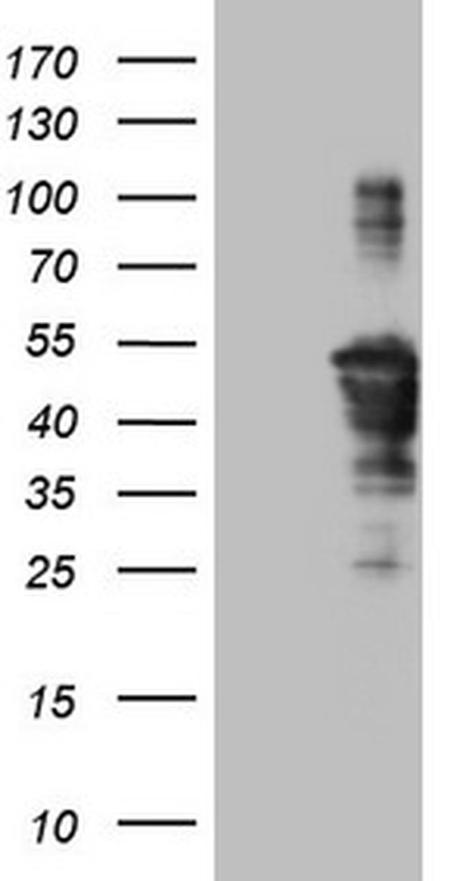 TCP10 Antibody in Western Blot (WB)