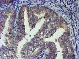 TCP11L2 Antibody in Immunohistochemistry (Paraffin) (IHC (P))