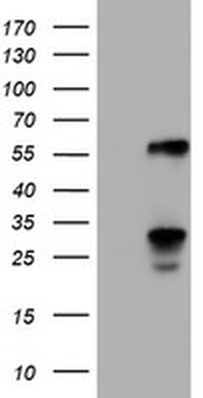 TCP11L2 Antibody in Western Blot (WB)