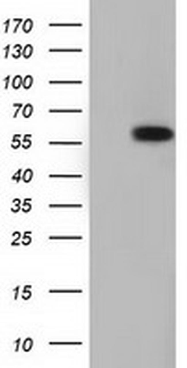 TCP11L2 Antibody in Western Blot (WB)