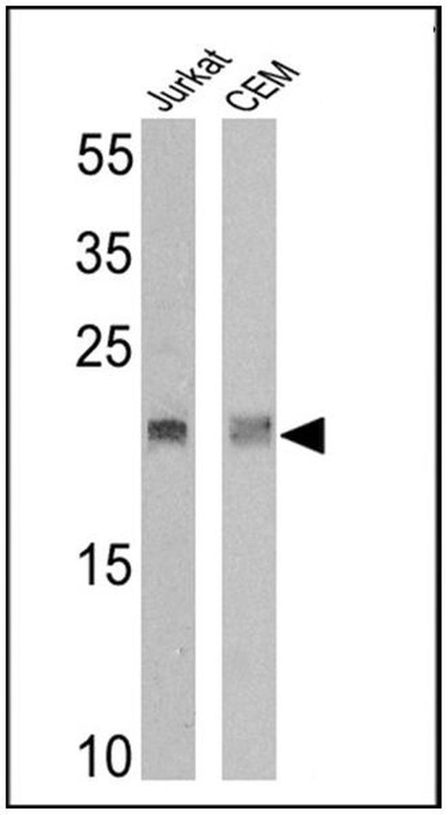 TCR V delta 2 Antibody in Western Blot (WB)