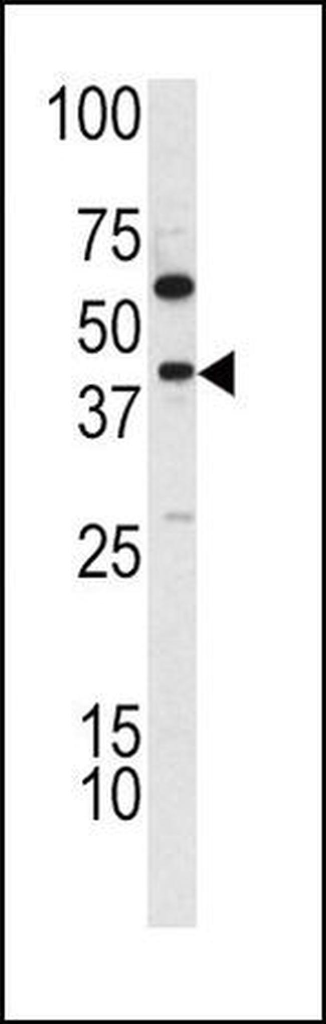 TDG Antibody in Western Blot (WB)