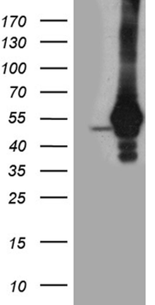 TDP2 Antibody in Western Blot (WB)