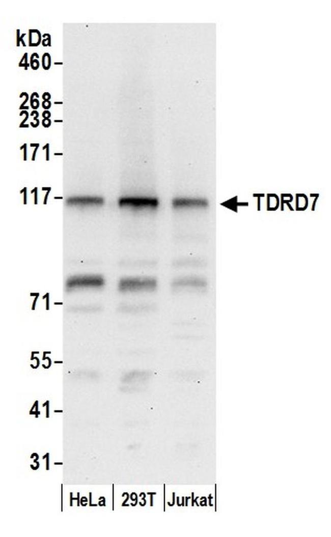 TDRD7 Antibody in Western Blot (WB)