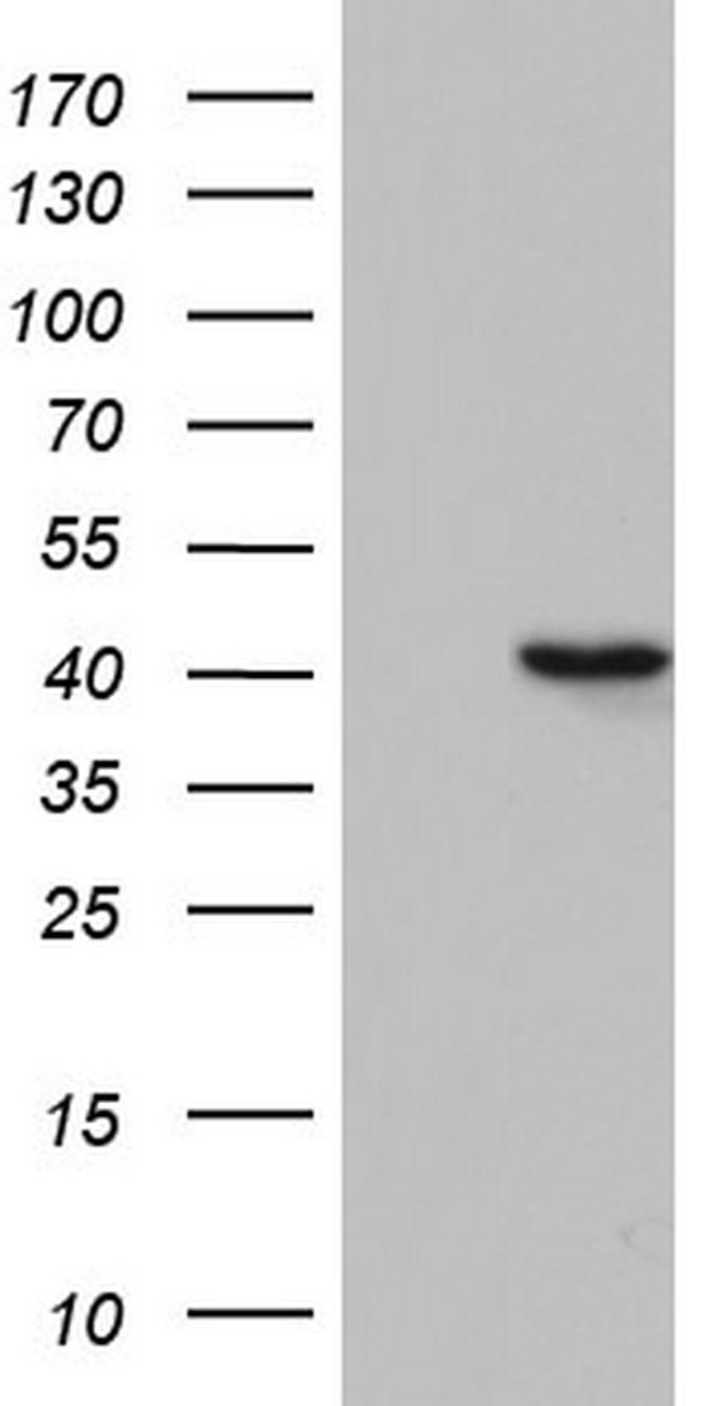 TFB1M Antibody in Western Blot (WB)