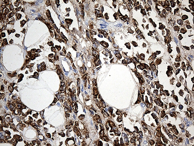 TFF1 Antibody in Immunohistochemistry (Paraffin) (IHC (P))