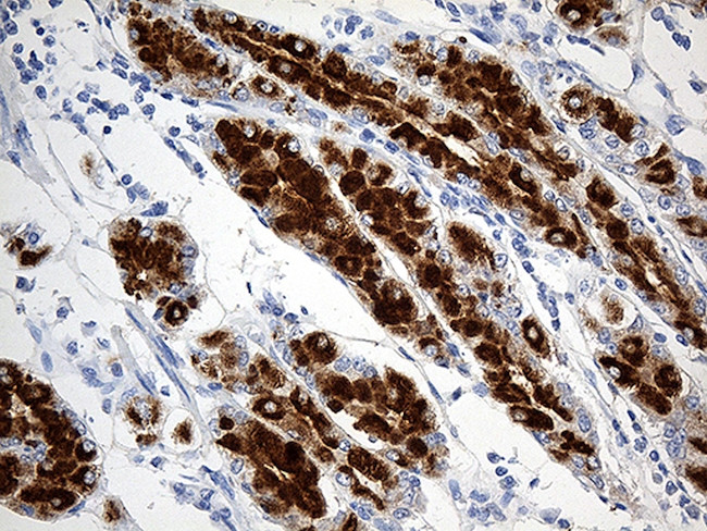 TFF1 Antibody in Immunohistochemistry (Paraffin) (IHC (P))