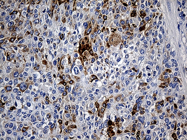 TFF1 Antibody in Immunohistochemistry (Paraffin) (IHC (P))