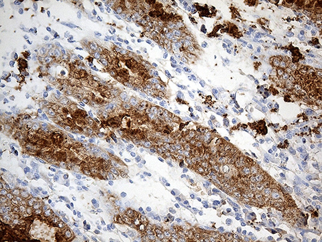 TFF1 Antibody in Immunohistochemistry (Paraffin) (IHC (P))