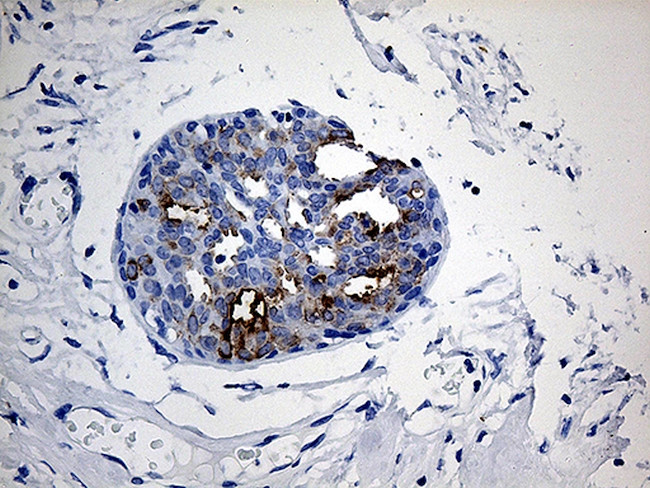 TFF1 Antibody in Immunohistochemistry (Paraffin) (IHC (P))