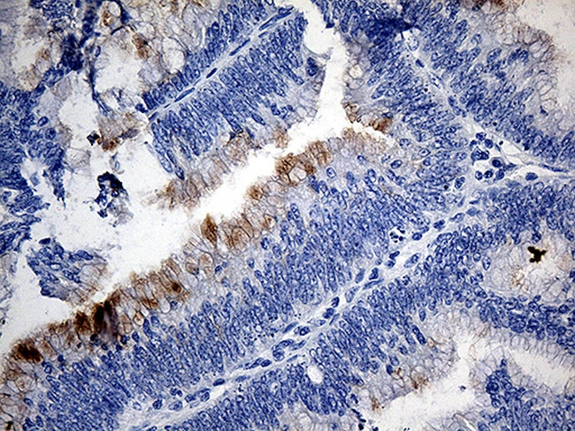 TFF1 Antibody in Immunohistochemistry (Paraffin) (IHC (P))