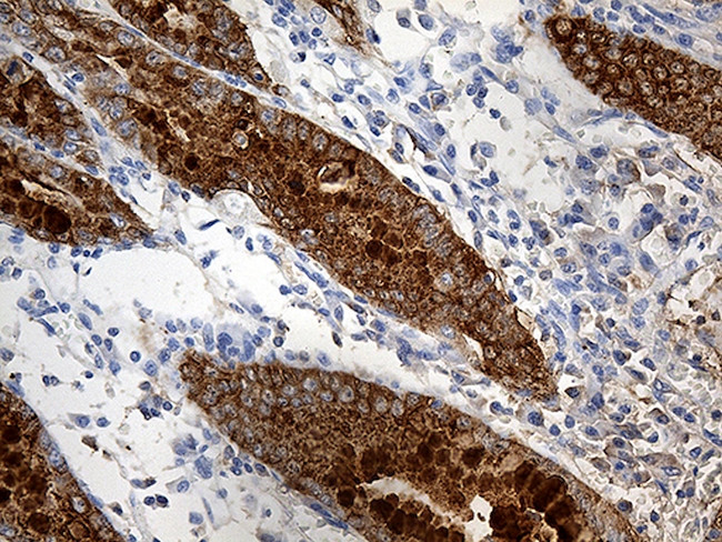 TFF1 Antibody in Immunohistochemistry (Paraffin) (IHC (P))