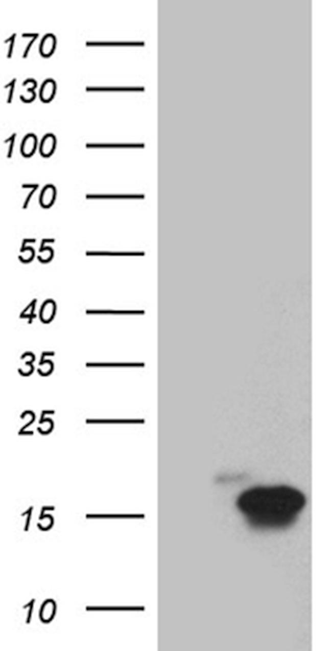 TFF1 Antibody in Western Blot (WB)