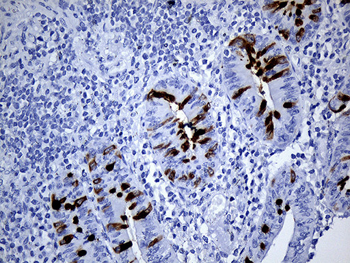 TFF3 Antibody in Immunohistochemistry (Paraffin) (IHC (P))