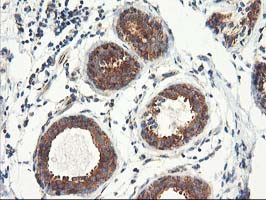 TFG Antibody in Immunohistochemistry (Paraffin) (IHC (P))