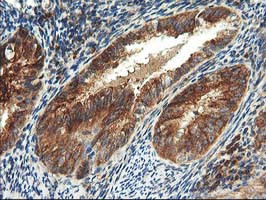 TFG Antibody in Immunohistochemistry (Paraffin) (IHC (P))