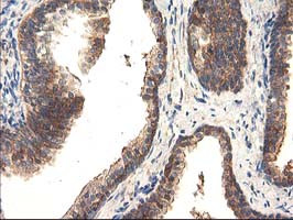 TFG Antibody in Immunohistochemistry (Paraffin) (IHC (P))