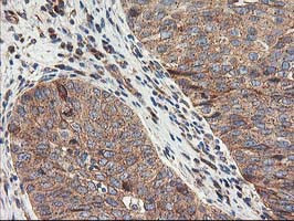 TFG Antibody in Immunohistochemistry (Paraffin) (IHC (P))