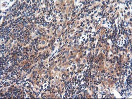 TFG Antibody in Immunohistochemistry (Paraffin) (IHC (P))