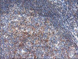 TFG Antibody in Immunohistochemistry (Paraffin) (IHC (P))