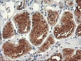 TFG Antibody in Immunohistochemistry (Paraffin) (IHC (P))