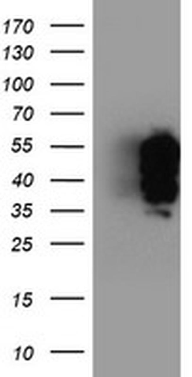 TFG Antibody in Western Blot (WB)