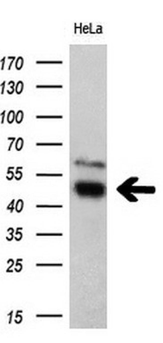 TFG Antibody in Western Blot (WB)