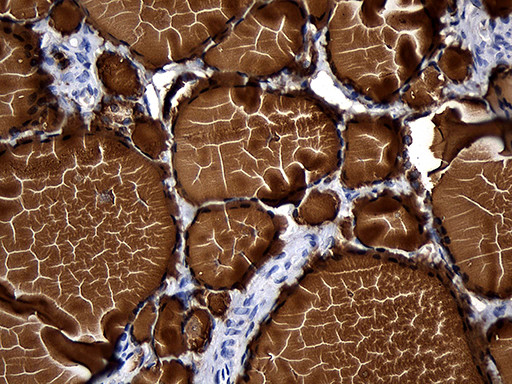 TG Antibody in Immunohistochemistry (Paraffin) (IHC (P))