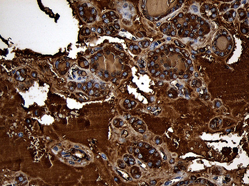 TG Antibody in Immunohistochemistry (Paraffin) (IHC (P))