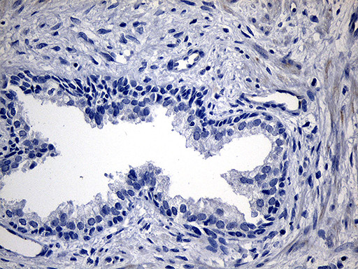 TG Antibody in Immunohistochemistry (Paraffin) (IHC (P))