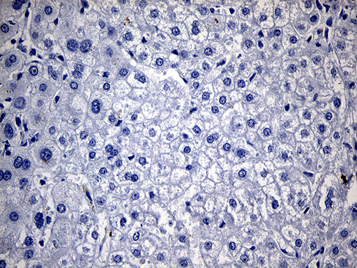 TG Antibody in Immunohistochemistry (Paraffin) (IHC (P))