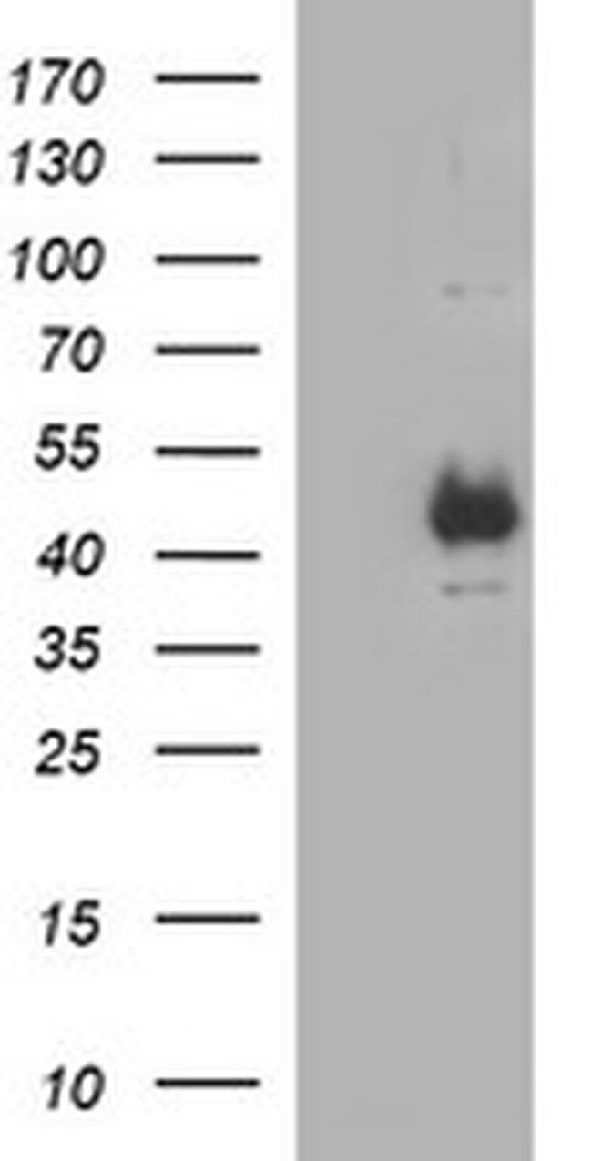 TGFB1 Antibody in Western Blot (WB)