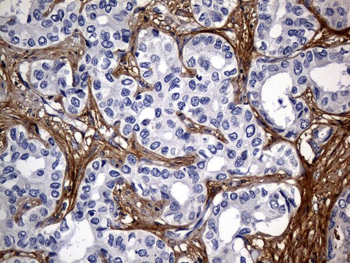 TGFBI Antibody in Immunohistochemistry (Paraffin) (IHC (P))