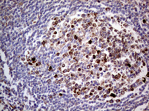 TGFBR3 Antibody in Immunohistochemistry (Paraffin) (IHC (P))