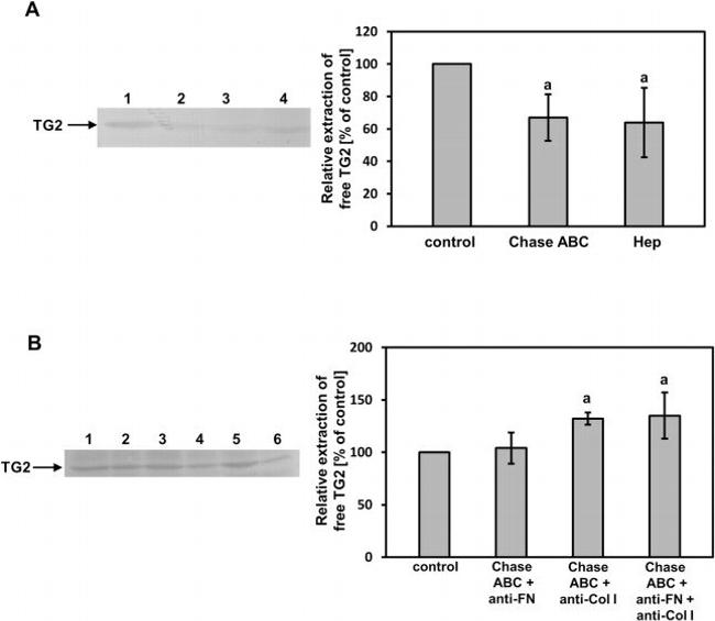 TGM2 Antibody in Western Blot (WB)