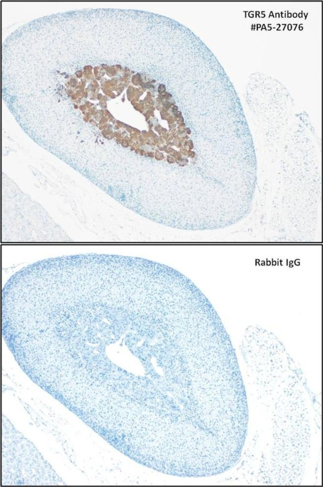 TGR5 Antibody in Immunohistochemistry (IHC)