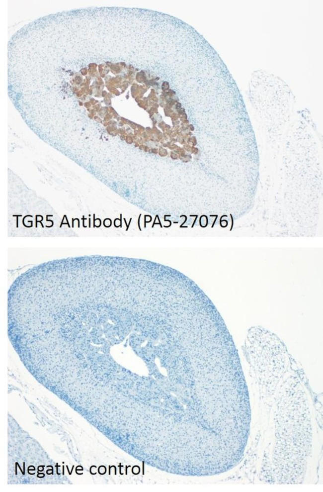 TGR5 Antibody in Immunohistochemistry (IHC)